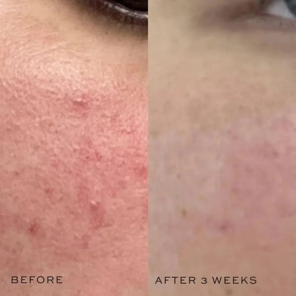✨ DIME Beauty Mini Super Skin Toner ✨